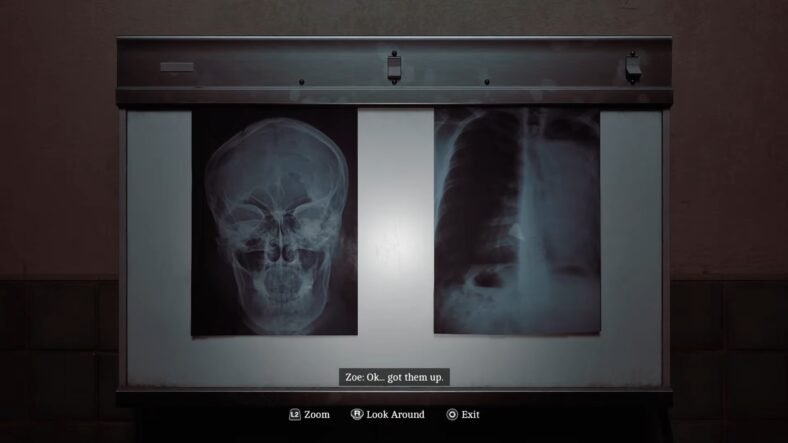 Silent Hill: Townfall How to take Patient X-Rays