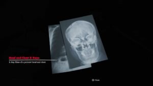 Silent Hill: Townfall How to take Patient X-Rays